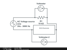 EKG