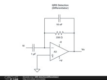 QRS detection(differentiator)